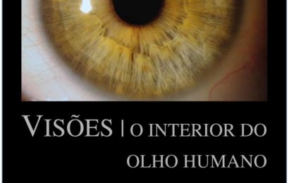Museu Francisco de Lacerda promove exposição “Visões: o interior do olho humano” – Ilha de São Jorge